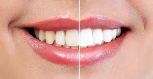Consultório Odontológico - Estética facial, dentes clareados e saudáveis.